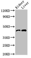 BLZF1 Antibody - Western Blot Positive WB detected in:Mouse kidney tissue,Mouse liver tissue All Lanes:BLZF1 antibody at 3µg/ml Secondary Goat polyclonal to rabbit IgG at 1/50000 dilution Predicted band size: 45,20 KDa Observed band size: 45 KDa