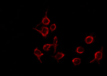 BLZF1 Antibody - Staining HeLa cells by IF/ICC. The samples were fixed with PFA and permeabilized in 0.1% Triton X-100, then blocked in 10% serum for 45 min at 25°C. The primary antibody was diluted at 1:200 and incubated with the sample for 1 hour at 37°C. An Alexa Fluor 594 conjugated goat anti-rabbit IgG (H+L) Ab, diluted at 1/600, was used as the secondary antibody.