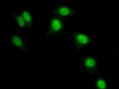 BM022 / MRPL1 Antibody - Western Blot; Sample: Recombinant MRPL1, Human