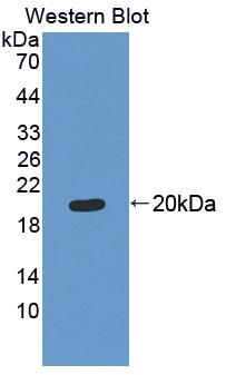 BM022 / MRPL1 Antibody - Western blot of BM022 / MRPL1 antibody.