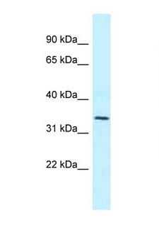 BM022 / MRPL1 Antibody - MRPL1 antibody Western blot of Jurkat Cell lysate. Antibody concentration 1 ug/ml.  This image was taken for the unconjugated form of this product. Other forms have not been tested.