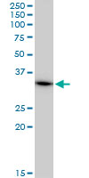 BM022 / MRPL1 Antibody - MRPL1 monoclonal antibody (M02), clone 2C4. Western blot of MRPL1 expression in A-431.