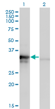 BM022 / MRPL1 Antibody - Western blot of MRPL1 expression in transfected 293T cell line by MRPL1 monoclonal antibody (M02), clone 2C4.
