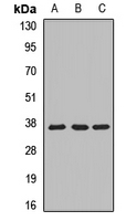 BM022 / MRPL1 Antibody