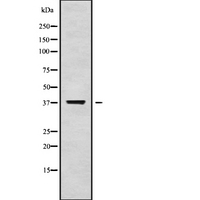BM022 / MRPL1 Antibody - Western blot analysis of MRPL1 using K562 whole cells lysates