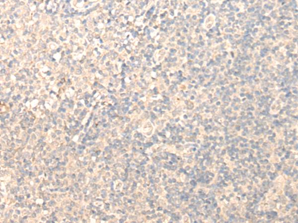 BM022 / MRPL1 Antibody - Immunohistochemistry of paraffin-embedded Human tonsil tissue  using MRPL1 Polyclonal Antibody at dilution of 1:25(×200)