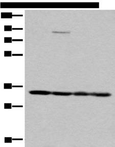 BM022 / MRPL1 Antibody - Western blot analysis of K562 HEPG2 231 and Jurkat cell lysates  using MRPL1 Polyclonal Antibody at dilution of 1:350