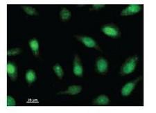 BMAL2 / ARNTL2 Antibody - Immunofluorescent staining using ARNTL2 antibody. Immunostaining analysis in HeLa cells. HeLa cells were fixed with 4% paraformaldehyde and permeabilized with 0.01% Triton-X100 in PBS. The cells were immunostained with anti-ARNTL2 antibody.