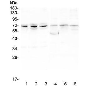 BMAL2 / ARNTL2 Antibody - Western blot testing of 1) human PC-3, 2) human A549, 3) human HepG2, 4) rat ovary, 5) rat lung and 6) rat testis lysate with ARNTL2 antibody at 0.5ug/ml. Predicted molecular weight ~71 kDa.