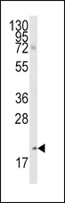 BMF Antibody - Western blot of anti-Bmf BH3 Domain Antibody in A2058 cell line lysates (35 ug/lane). Bmf(arrow) was detected using the purified antibody.