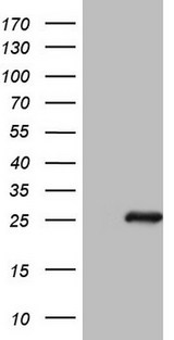 BMF Antibody - HEK293T cells were transfected with the pCMV6-ENTRY control. (Left lane) or pCMV6-ENTRY BMF. (Right lane) cDNA for 48 hrs and lysed. Equivalent amounts of cell lysates. (5 ug per lane) were separated by SDS-PAGE and immunoblotted with anti-BMF.