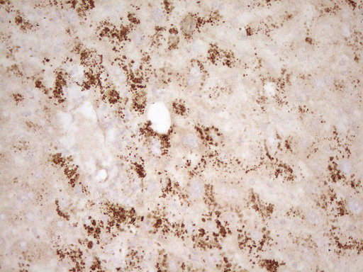 BMF Antibody - Immunohistochemical staining of paraffin-embedded Human liver tissue within the normal limits using anti-BMF mouse monoclonal antibody. (Heat-induced epitope retrieval by 1 mM EDTA in 10mM Tris, pH8.5, 120C for 3min,