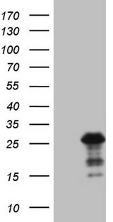 BMF Antibody - HEK293T cells were transfected with the pCMV6-ENTRY control. (Left lane) or pCMV6-ENTRY BMF. (Right lane) cDNA for 48 hrs and lysed. Equivalent amounts of cell lysates. (5 ug per lane) were separated by SDS-PAGE and immunoblotted with anti-BMF. (1:2000)