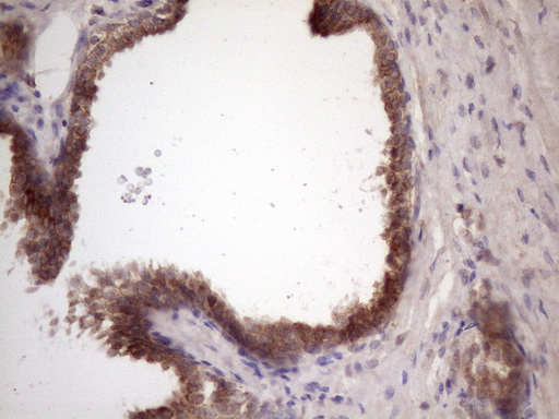 BMF Antibody - Immunohistochemical staining of paraffin-embedded Human prostate tissue within the normal limits using anti-BMF mouse monoclonal antibody. (Heat-induced epitope retrieval by 1 mM EDTA in 10mM Tris, pH8.5, 120C for 3min. (1:150)