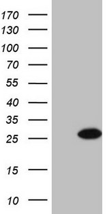 BMF Antibody - HEK293T cells were transfected with the pCMV6-ENTRY control (Left lane) or pCMV6-ENTRY BMF (Right lane) cDNA for 48 hrs and lysed. Equivalent amounts of cell lysates (5 ug per lane) were separated by SDS-PAGE and immunoblotted with anti-BMF (1:2000).