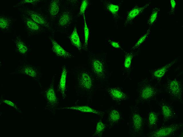 BMF Antibody - Immunofluorescence staining of BMF in HeLa cells. Cells were fixed with 4% PFA, permeabilzed with 0.1% Triton X-100 in PBS, blocked with 10% serum, and incubated with rabbit anti-Human BMF polyclonal antibody (dilution ratio 1:200) at 4°C overnight. Then cells were stained with the Alexa Fluor 488-conjugated Goat Anti-rabbit IgG secondary antibody (green). Positive staining was localized to Nucleus and Cytoplasm.