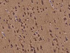 BMF Antibody - Immunochemical staining of human BMF in human brain with rabbit polyclonal antibody at 1:100 dilution, formalin-fixed paraffin embedded sections.