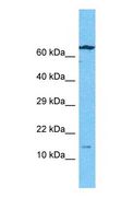 BMF Antibody - Western blot of BMF Antibody with human Ovary Tumor lysate.  This image was taken for the unconjugated form of this product. Other forms have not been tested.