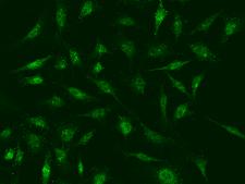 BMF Antibody - Immunofluorescence staining of BMF in Hela cells. Cells were fixed with 4% PFA, permeabilzed with 0.1% Triton X-100 in PBS, blocked with 10% serum, and incubated with rabbit anti-human BMF polyclonal antibody (dilution ratio 1:5000) at 4°C overnight. Then cells were stained with the Alexa Fluor 488-conjugated Goat Anti-rabbit IgG secondary antibody (green). Positive staining was localized to cytoplasm and nucleus.