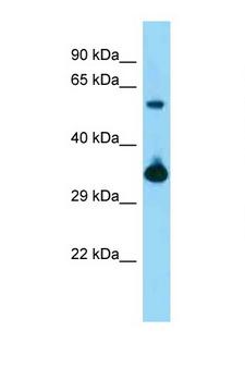 BMI1 / PCGF4 Antibody - BMI1 antibody Western blot of Mouse Kidney lysate. Antibody concentration 1 ug/ml.  This image was taken for the unconjugated form of this product. Other forms have not been tested.