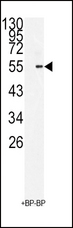 BMI1 / PCGF4 Antibody - Western blot of BMI1 Antibody antibody in 293 cell line lysates (35 ug/lane). BMI1(arrow) was detected using the purified antibody.