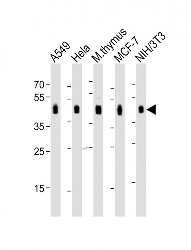 BMI1 / PCGF4 Antibody - All lanes: Anti-BMI1 Antibody (C-term) at 1:1000-1:2000 dilution. Lane 1: A549 whole cell lysate. Lane 2: HeLa whole cell lysate. Lane 3: mouse thymus lysate. Lane 4: MCF-7 whole cell lysate. Lane 5: NIH/3T3 whole cell lysate Lysates/proteins at 20 ug per lane. Secondary Goat Anti-Rabbit IgG, (H+L), Peroxidase conjugated at 1:10000 dilution. Predicted band size: 37 kDa. . Blocking/Dilution buffer: 5% NFDM/TBST.