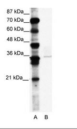 BMI1 / PCGF4 Antibody - A: Marker, B: A172 Cell Lysate.  This image was taken for the unconjugated form of this product. Other forms have not been tested.