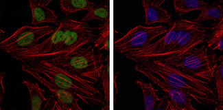 BMI1 / PCGF4 Antibody - Immunofluorescence of HeLa cells using BMI1 mouse monoclonal antibody (green). Blue: DRAQ5 fluorescent DNA dye. Red: Actin filaments have been labeled with Alexa Fluor-555 phalloidin.