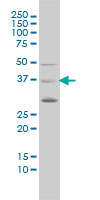 BMI1 / PCGF4 Antibody - PCGF4 monoclonal antibody (M02), clone 4E10-1C5 Western Blot analysis of PCGF4 expression in A-549.