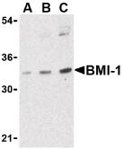 BMI1 / PCGF4 Antibody - Western blot of BMI-1 in K562 cell lysate with BMI-1 Antibody at (A) 0.5, (B) 1 and (C) 2 ug/ml.