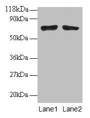 BMI1 / PCGF4 Antibody - Western blot All lanes: Polycomb complex protein BMI-1 antibodyt 2µg/ml Lane 1: EC109 whole cell lysate Lane 2: 293T whole cell lysate Secondary Goat polyclonal to rabbit IgG at 1/15000 dilution Predicted band size: 36 kDa Observed band size: 70 kDa