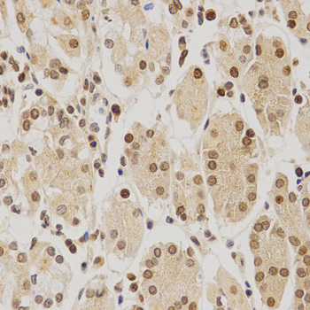 BMI1 / PCGF4 Antibody - Immunohistochemistry of paraffin-embedded human stomach using BMI1 antibody at dilution of 1:200 (x400 lens).