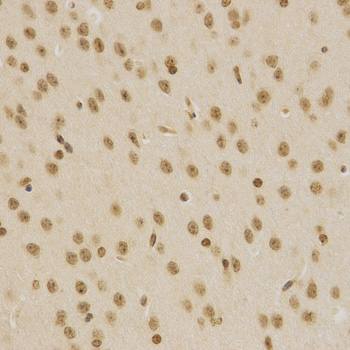 BMI1 / PCGF4 Antibody - Immunohistochemistry of paraffin-embedded mouse brain using BMI1 antibody at dilution of 1:200 (x400 lens).