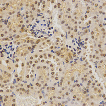 BMI1 / PCGF4 Antibody - Immunohistochemistry of paraffin-embedded mouse kidney using BMI1 antibody at dilution of 1:200 (x400 lens).