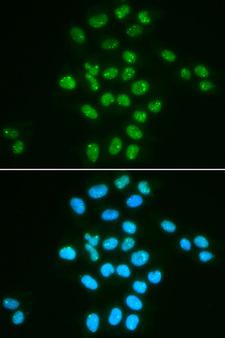 BMI1 / PCGF4 Antibody - Immunofluorescence analysis of HeLa cell using BMI1 antibody. Blue: DAPI for nuclear staining.