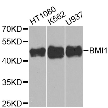 BMI1 / PCGF4 Antibody - Western blot analysis of extracts of various cell lines, using BMI1 antibody at 1:1000 dilution. The secondary antibody used was an HRP Goat Anti-Rabbit IgG (H+L) at 1:10000 dilution. Lysates were loaded 25ug per lane and 3% nonfat dry milk in TBST was used for blocking. An ECL Kit was used for detection and the exposure time was 90s.