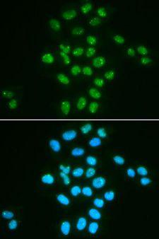 BMI1 / PCGF4 Antibody - Immunofluorescence analysis of HeLa cells using BMI1 antibody. Blue: DAPI for nuclear staining.