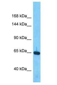 BMP1 Antibody - BMP1 / BMP-1 antibody Western Blot of ACHN. Antibody dilution: 1 ug/ml.  This image was taken for the unconjugated form of this product. Other forms have not been tested.