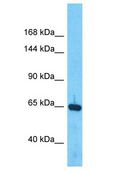 BMP1 Antibody - BMP1 / BMP-1 antibody Western Blot of ACHN. Antibody dilution: 1 ug/ml.  This image was taken for the unconjugated form of this product. Other forms have not been tested.