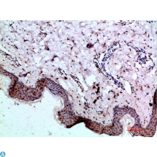 BMP1 Antibody - Immunohistochemical analysis of paraffin-embedded human-skin, antibody was diluted at 1:200.