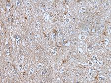 BMP1 Antibody - Immunohistochemistry of paraffin-embedded Human brain tissue  using BMP1 Polyclonal Antibody at dilution of 1:105(×200)