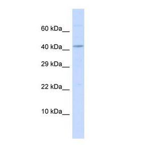 BMP10 Antibody - Western blot of Human MCF7. BMP10 antibody dilution 1.0 ug/ml.  This image was taken for the unconjugated form of this product. Other forms have not been tested.
