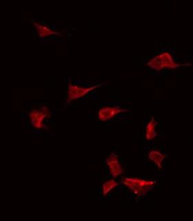 BMP10 Antibody - Staining HeLa cells by IF/ICC. The samples were fixed with PFA and permeabilized in 0.1% Triton X-100, then blocked in 10% serum for 45 min at 25°C. The primary antibody was diluted at 1:200 and incubated with the sample for 1 hour at 37°C. An Alexa Fluor 594 conjugated goat anti-rabbit IgG (H+L) Ab, diluted at 1/600, was used as the secondary antibody.