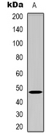 BMP12 / GDF7 Antibody - Western blot analysis of GDF7 expression in HeLa (A) whole cell lysates.