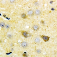 BMP12 / GDF7 Antibody - Immunohistochemical analysis of GDF7 staining in human brain formalin fixed paraffin embedded tissue section. The section was pre-treated using heat mediated antigen retrieval with sodium citrate buffer (pH 6.0). The section was then incubated with the antibody at room temperature and detected using an HRP polymer system. DAB was used as the chromogen. The section was then counterstained with hematoxylin and mounted with DPX.
