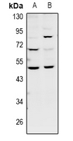 BMP12 / GDF7 Antibody - Western blot analysis of GDF7 expression in HCT116 (A), HepG2 (B) whole cell lysates.