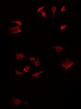 BMP12 / GDF7 Antibody - Staining HT29 cells by IF/ICC. The samples were fixed with PFA and permeabilized in 0.1% Triton X-100, then blocked in 10% serum for 45 min at 25°C. The primary antibody was diluted at 1:200 and incubated with the sample for 1 hour at 37°C. An Alexa Fluor 594 conjugated goat anti-rabbit IgG (H+L) Ab, diluted at 1/600, was used as the secondary antibody.