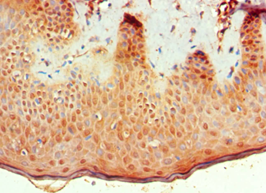 BMP15 Antibody - Immunohistochemistry of paraffin-embedded human skin using antibody at 1:100 dilution.