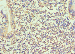 BMP15 Antibody - Immunohistochemistry of paraffin-embedded human small intestine tissue using BMP15 Antibody at dilution of 1:100