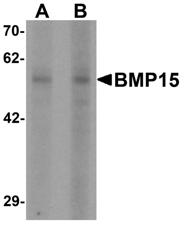 BMP15 Antibody - Western blot analysis of BMP15 in 3T3 cell lysate with BMP15 antibody at (A) 1 and (B) 2 ug/ml
